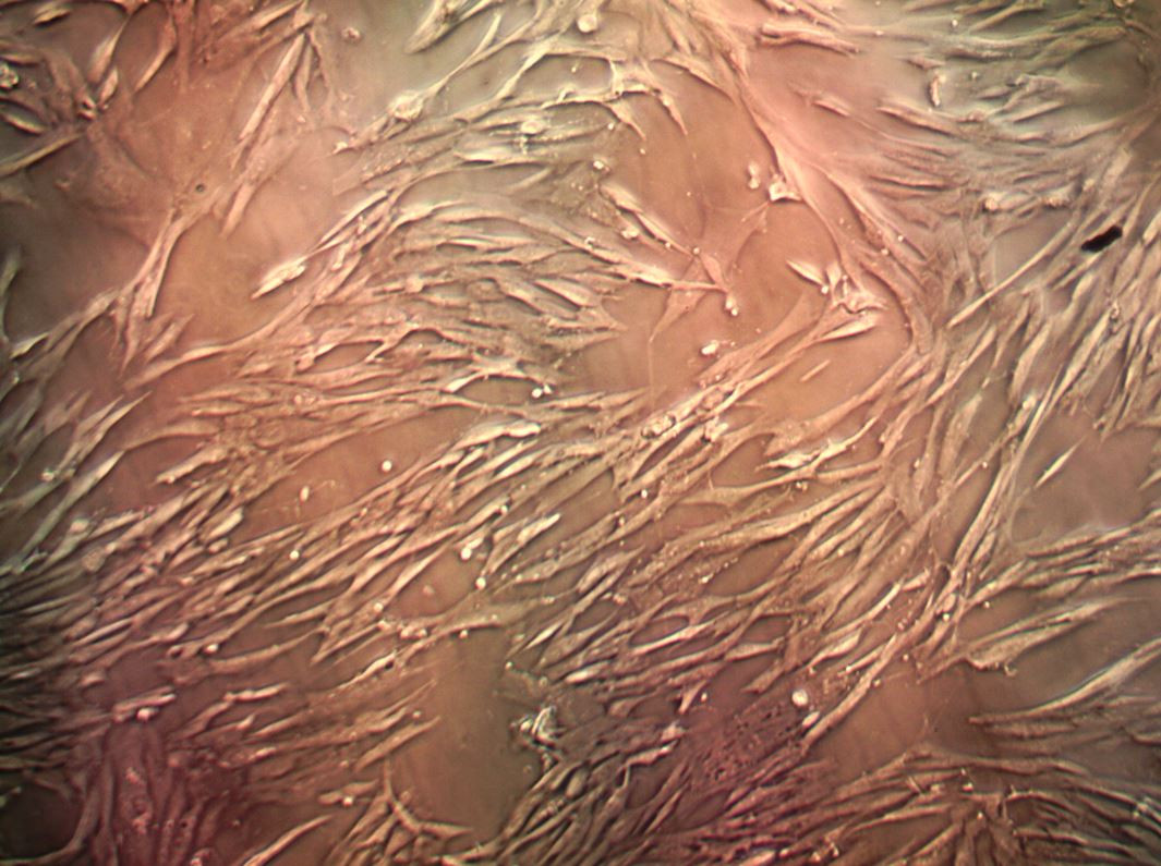 Immortalized Human Colorectal Fibroblast