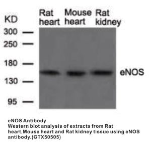 Anti-ENOS Rabbit Polyclonal Antibody