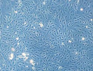 Human Dermal Blood Endothelial Cells