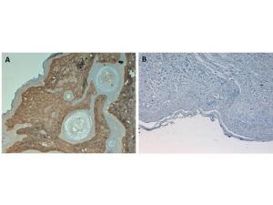 Anti-COL1A1 Rabbit Polyclonal Antibody