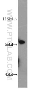 Anti-Collagen Type XXIII Rabbit Polyclonal Antibody