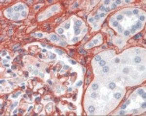 Anti-COL5A1 Rabbit Polyclonal Antibody