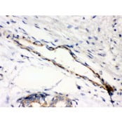 Anti-Caldesmon (Smooth) Antibody (Monoclonal, hHCD) CA1009