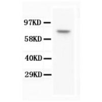 Anti-Calcineurin Alpha Antibody (Monoclonal, CN-A1) CA1008