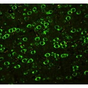 Anti-ABI1 Antibody K-PA1001