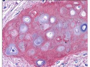 Anti-COL2A1 Rabbit Polyclonal Antibody