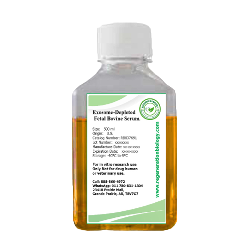 Exosome-Depleted Fetal Bovine Serum